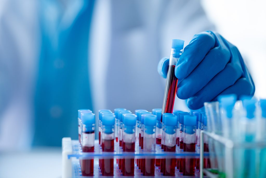Immune-Monitoring Unit 